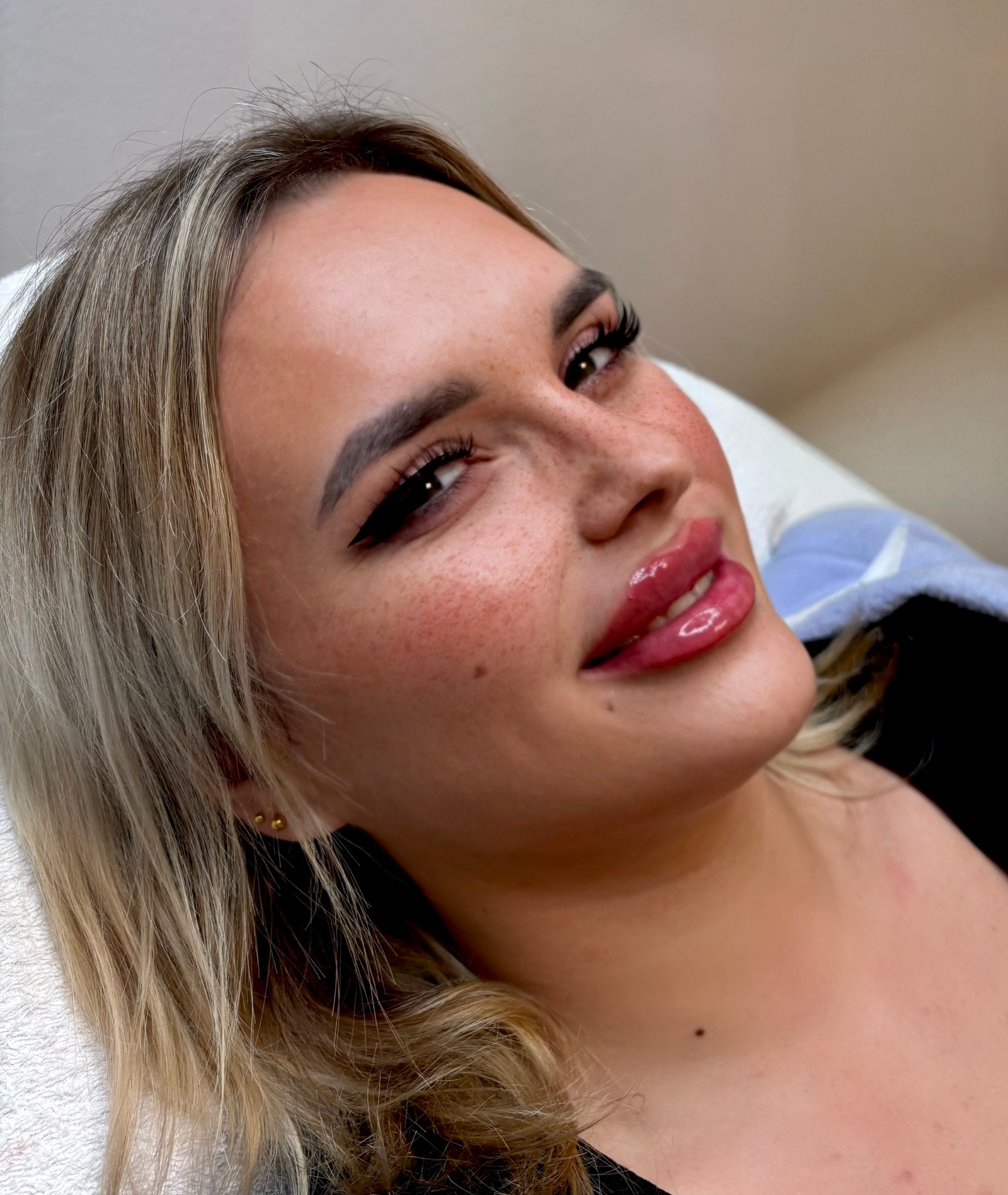Lippen aufspritzen